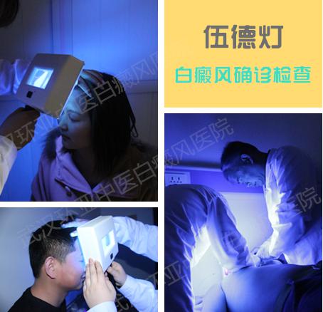 1495159646661672.jpg 伍德灯.jpg