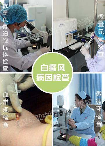 1495159879644432.jpg 病因检查.jpg